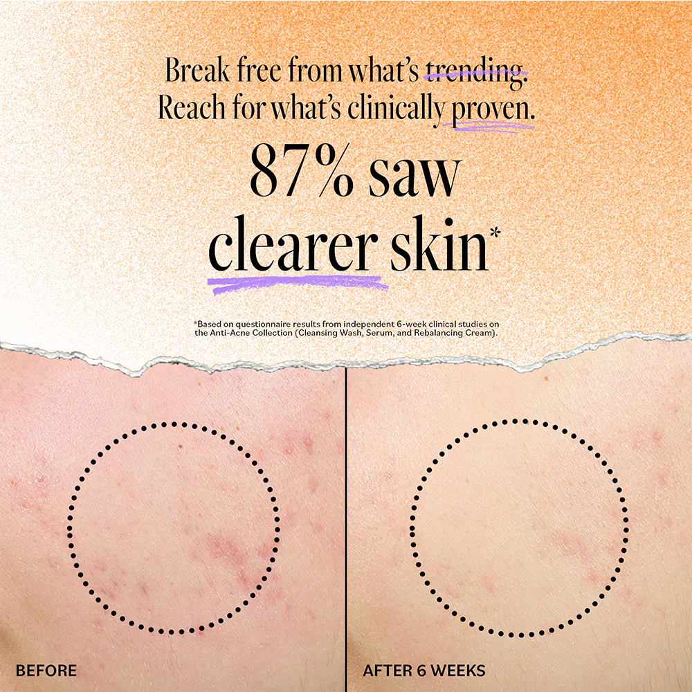 Acne Oil-Control Matte Moisturizer - Image 3
