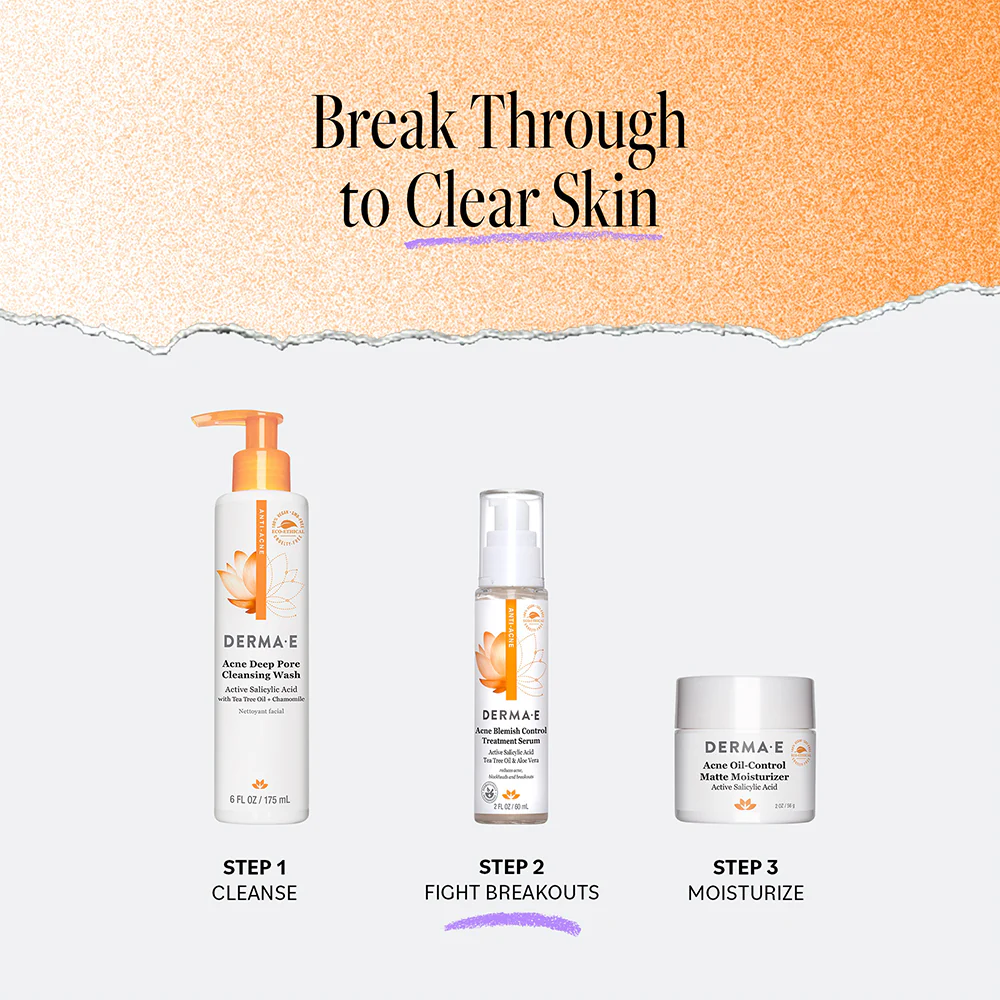 Acne Blemish Control Treatment Serum - Image 5