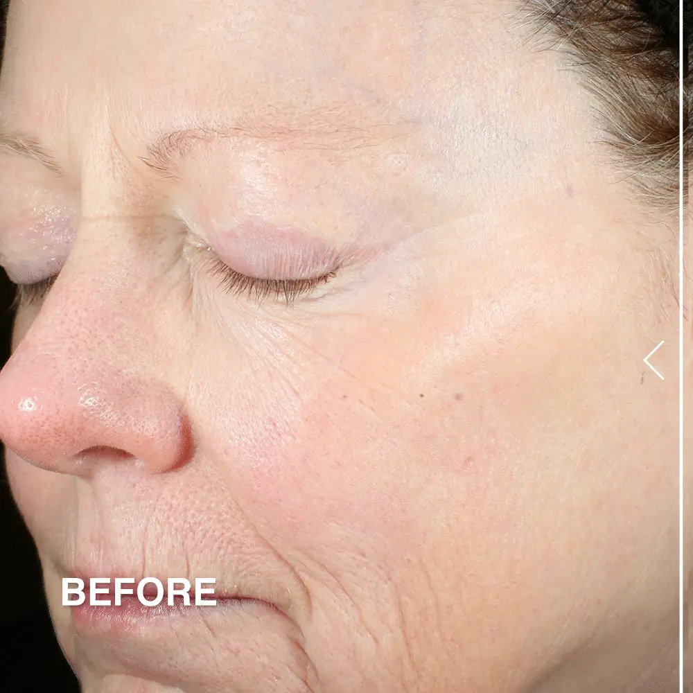 Advanced Peptides & Flora-Collagen™ Cryo-Gel Mask - Image 4
