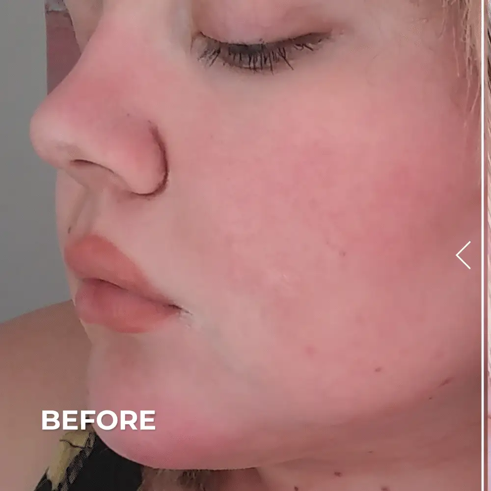 Pure Biome Balancing Serum - Image 5