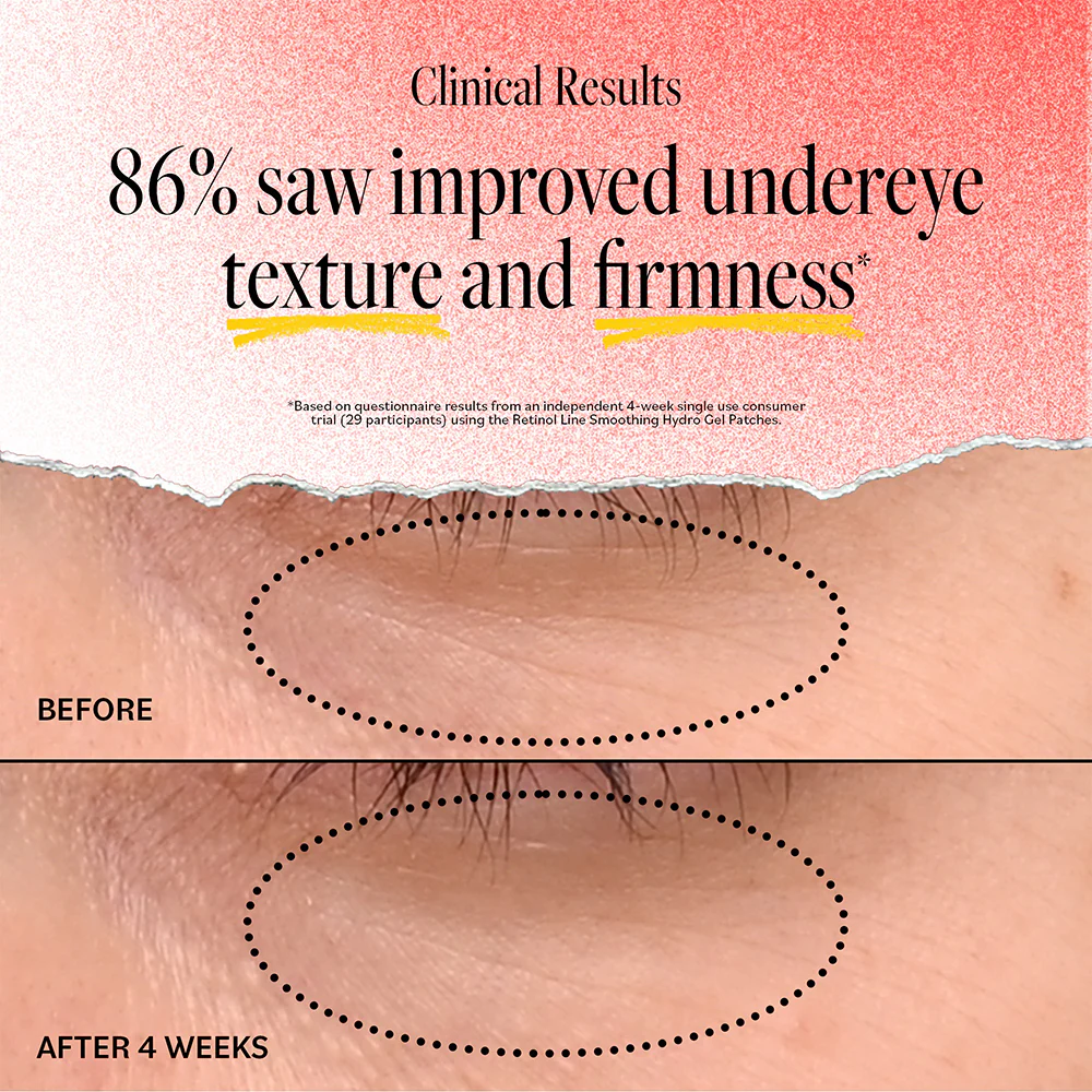 Retinol Line Smoothing Hydro Gel Patches - 5 Pack - Image 3
