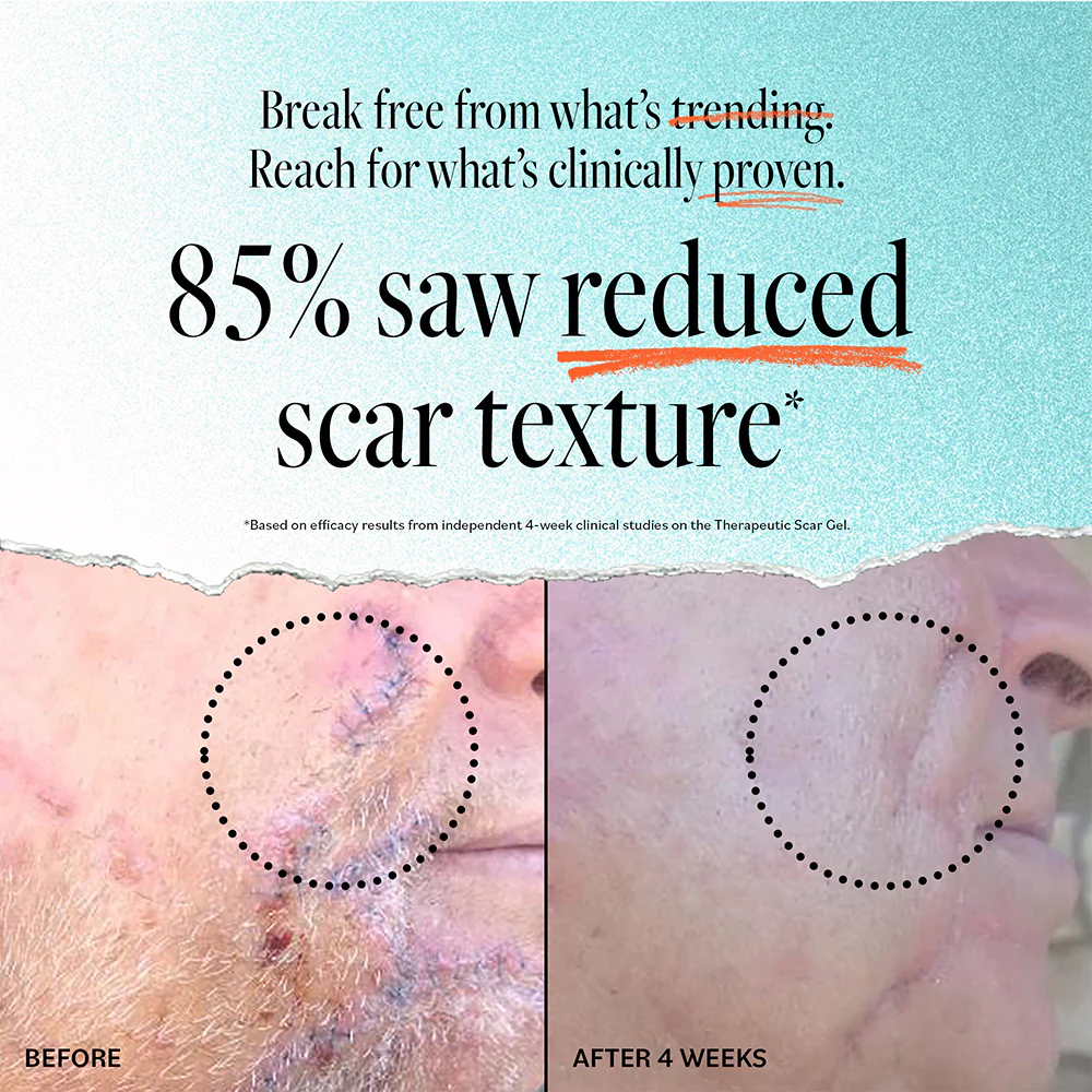 Scar Gel - Image 3