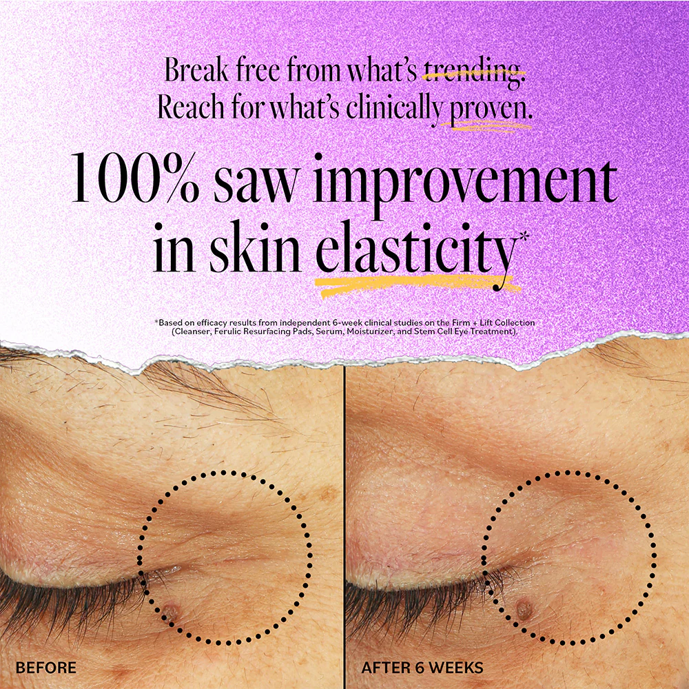 Stem Cell Eye Lifting Treatment - Image 3