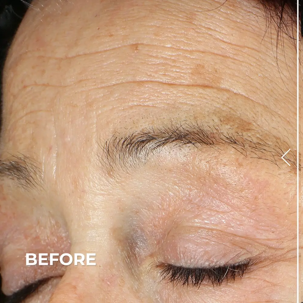 Ultra Lift DMAE Concentrated Serum - Image 4