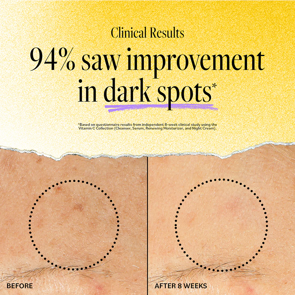 Vitamin C Concentrated Serum  - Image 3